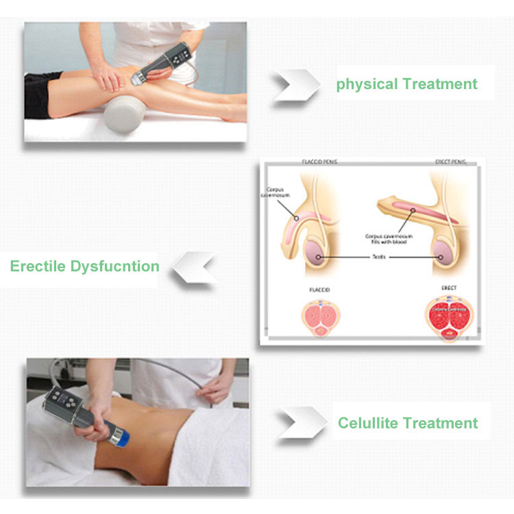 shockwave for physical therapy